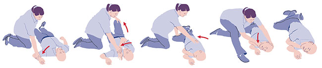 Illustration,stabile Seitenlage