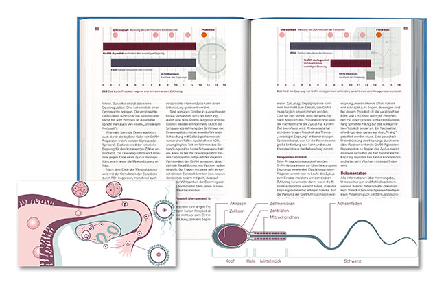 Illustration, Diagramme, Gebärmutter, Spermium